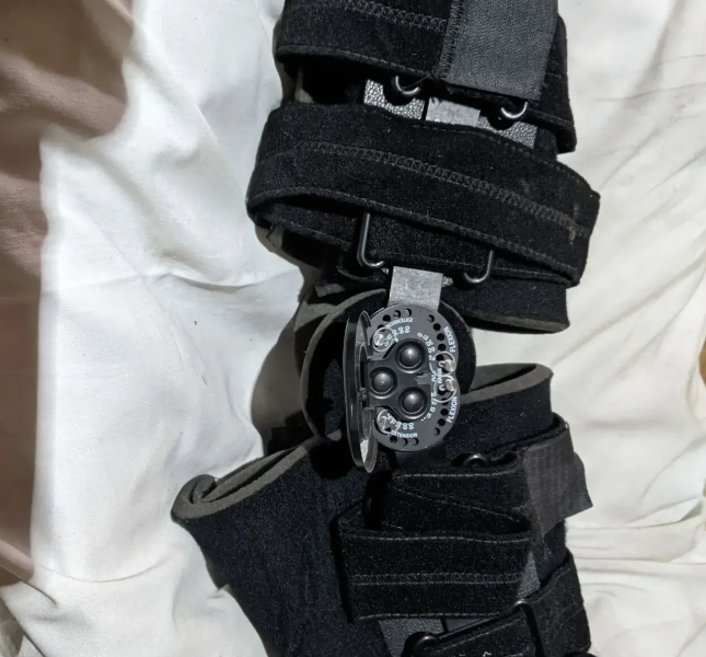 Тутторы, ортезы